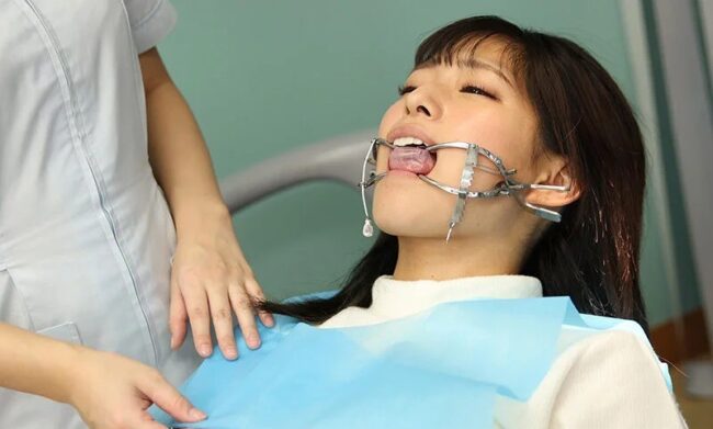 ホワイトヘッド開口器をつけた渚みつき